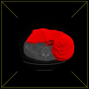 three.js webgl - 加载器 - 加载 NRRD