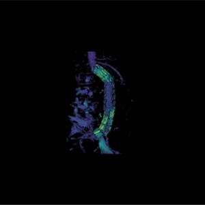 Three.js WebGL 体积渲染示例 - 医学影像三维可视化